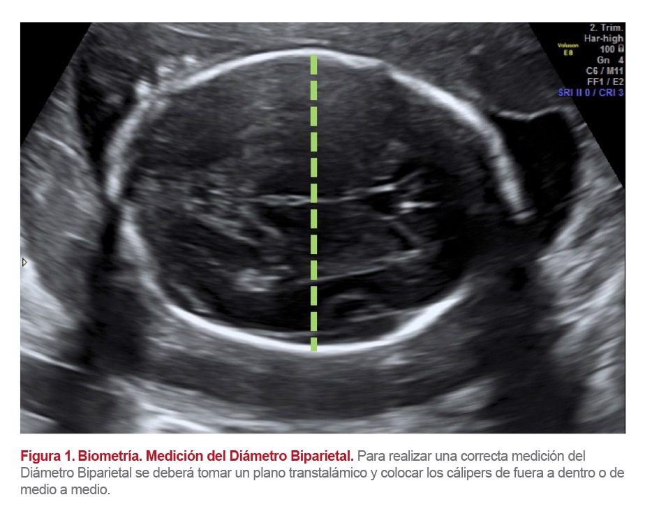 Módulo 1la Ecografía Del Segundo Trimestre De La Gestación Introducción Proformed 